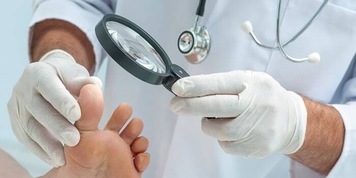 O médico examina o pé dun paciente cunha punta cunha lupa