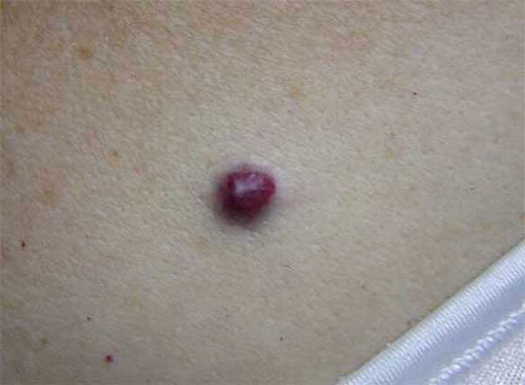 toupa vermella no corpo