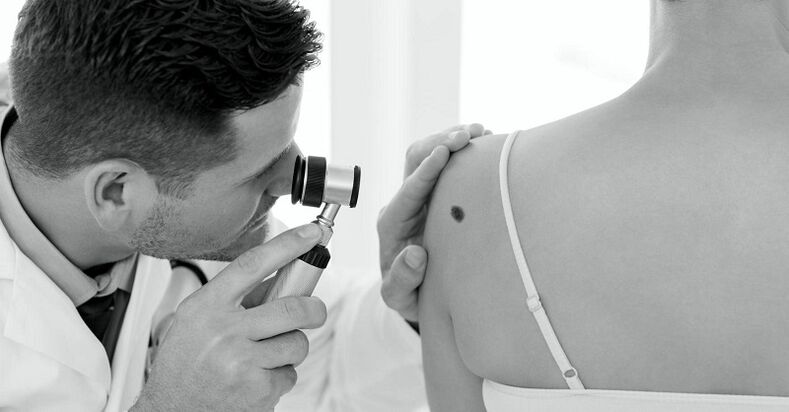 un especialista diagnostica o tipo de verruga